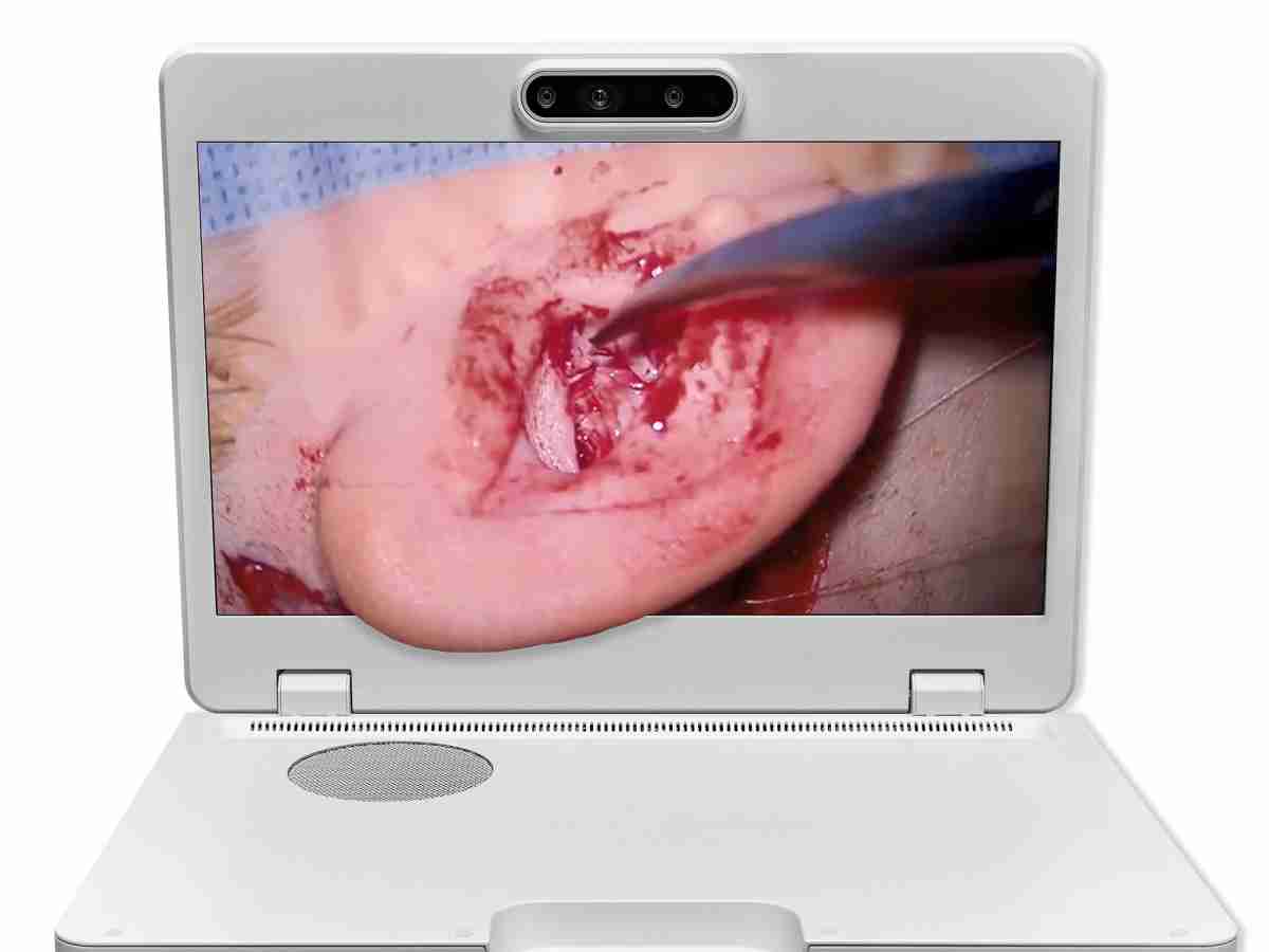 达擎之＂Heads-up 3D显微手术显示系统＂，，，整合4K裸眼3D显示及眼球追踪系统，，具备快速追踪人眼移动位置功能，，，，减轻医师长时间维持固定姿势的负担，，，让医师能有更宽广清晰的3D立体视野及更舒适的姿势来执行手术。。。。